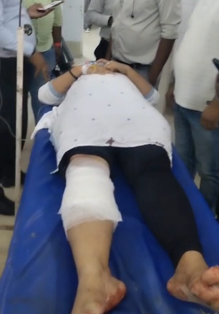 up-sbi-gunshot-injured-